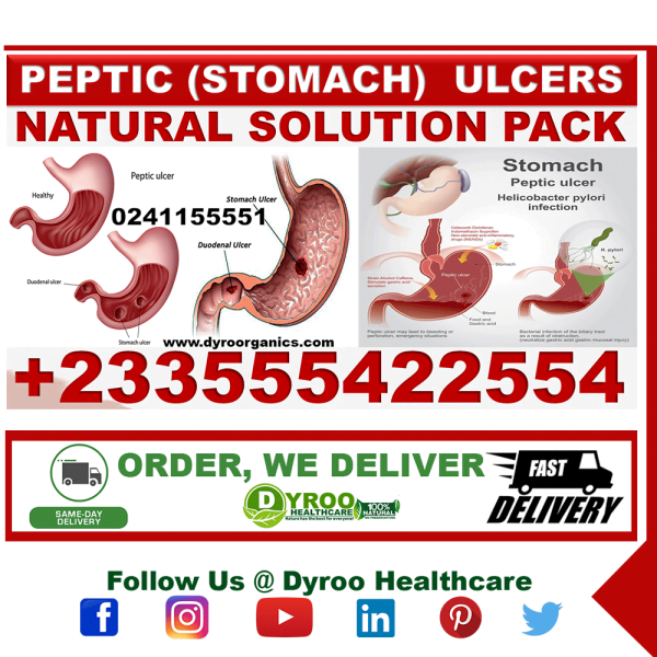 Aloe Vera Supplement for Gastric Ulcer in Ghana