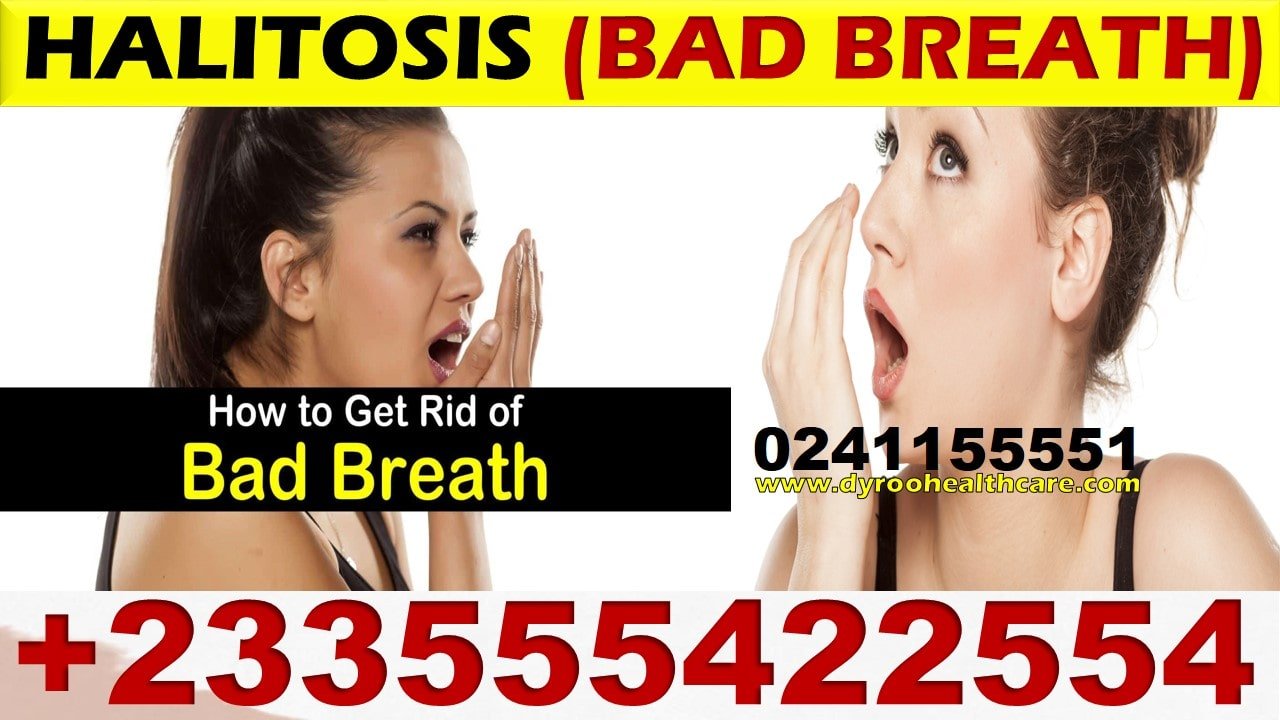 Bad Breath Natural Treatment in Ghana 
