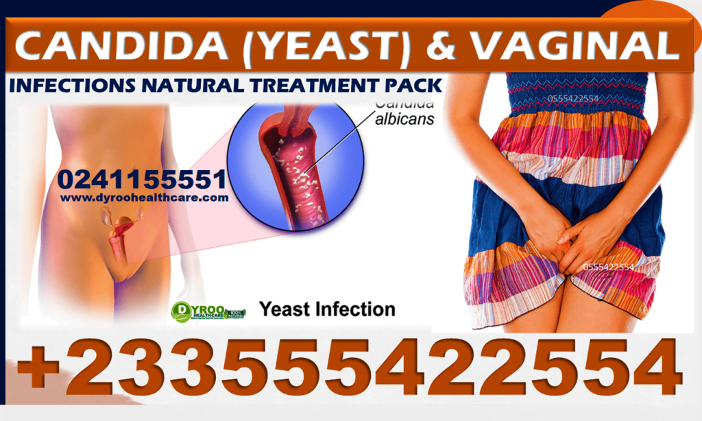 NATURAL SUPPLEMEMNTS FOR CANDIDA-VAGINAL INFECTIONS IN GHANA