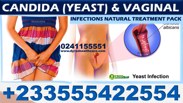 NATURAL REMEDY FOR CANDIDA-VAGINAL INFECTIONS IN GHANA