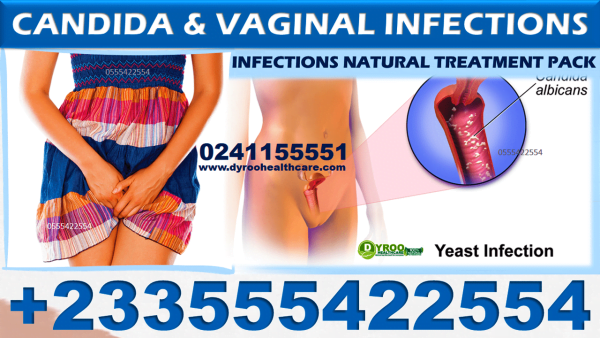 NATURAL REMEDY FOR CANDIDA-VAGINAL INFECTIONS IN GHANA