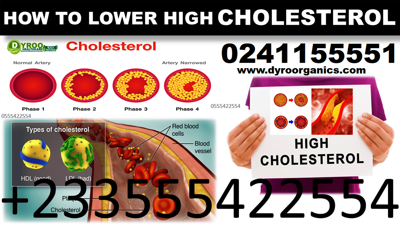 Forever Products for Cholesterol