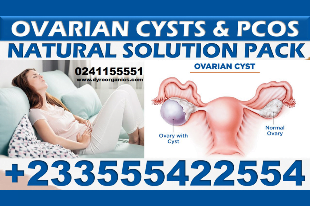 Forever Living Products for Ovarian Cysts