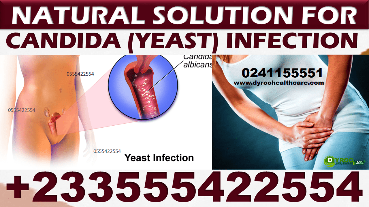 CANDIDIASIS - VAGINAL INFECTION PACK