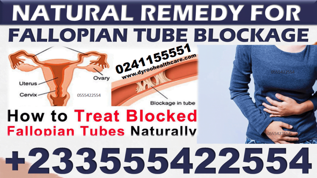 Natural Remedy For Fallopian Tube Blockage