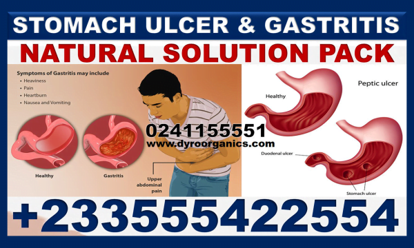 Pills for Gastrointestinal Ulcer in Ghana
