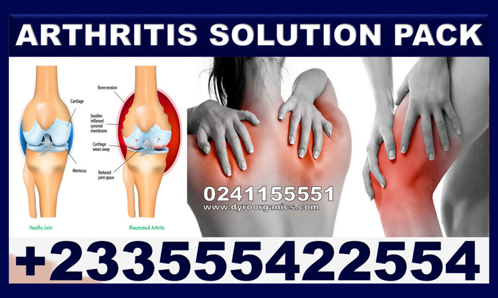 Forever Living Products for Arthritis