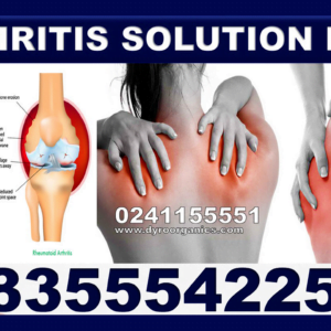 Aloe Vera Supplement for Arthritis in Ghana