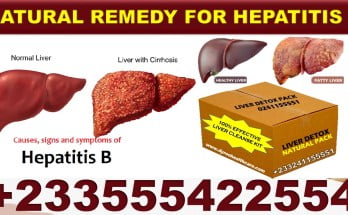 Natural Remedy for Hepatitis B