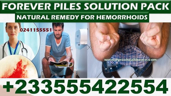 Best Natural Treatment for Hemorrhoids in Ghana