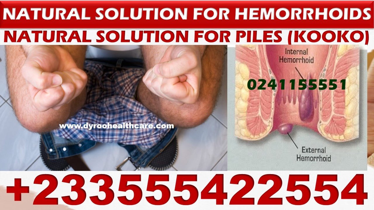 Hemorrhoids meaning