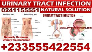 Best Pills for Urinary Disorder in Ghana