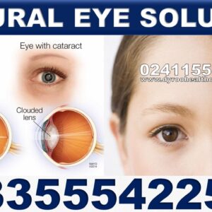 Natural Products for Cataract in Ghana
