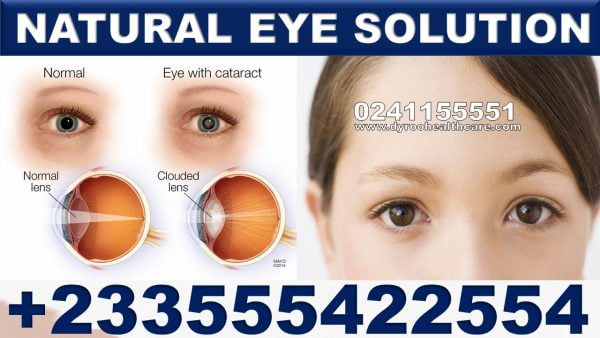 Natural Products for Cataract in Ghana